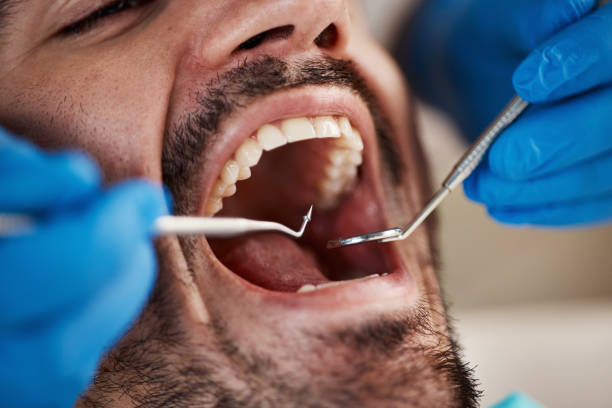 Best Urgent Dental Care for Toothaches in Arkwright, SC