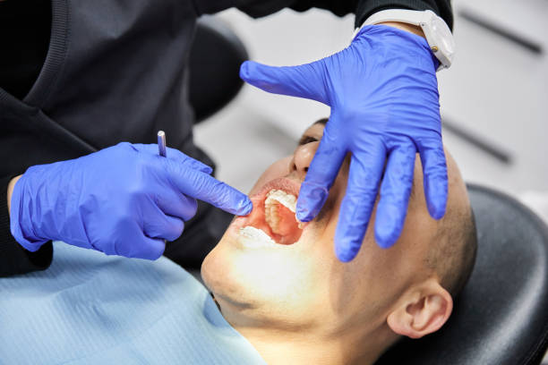 Best Dental Abscess Treatment in Arkwright, SC